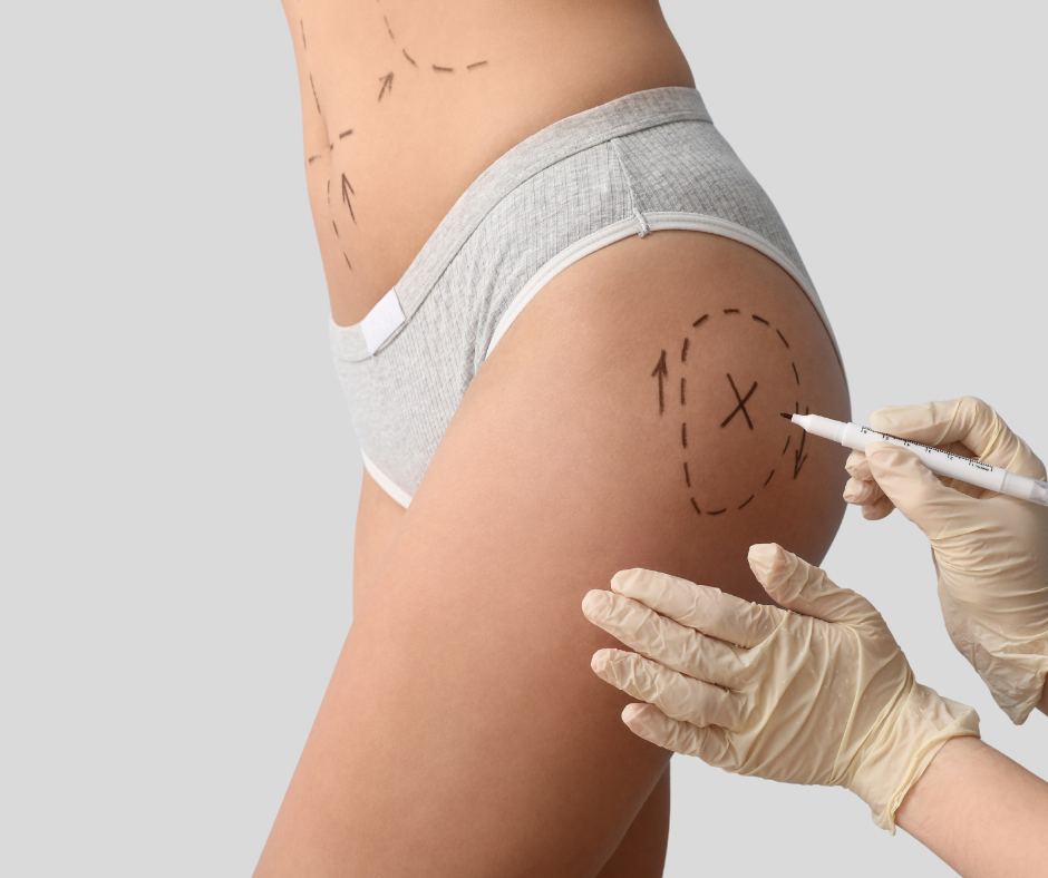 Manual lymph drainage session in Melbourne, FL